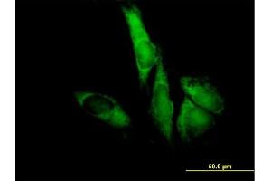 Immunofluorescence of purified MaxPab antibody to EIF3S5 on HeLa cell. (EIF3F Antikörper  (AA 1-357))