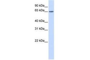 Image no. 1 for anti-YTH Domain Family, Member 3 (YTHDF3) (AA 108-157) antibody (ABIN6743846)