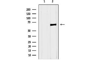 anti-Numb Homolog (Drosophila)-Like (NUMBL) (C-Term) antibody