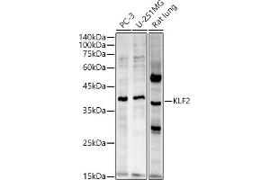 Western blot analysis of extracts of various cell lines, using KLF2 antibody (ABIN7268155) at 1:2720 dilution. (KLF2 Antikörper  (AA 50-150))