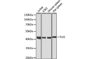 Western blot analysis of extracts of various cell lines, using TLX1 antibody. (TLX1 Antikörper)