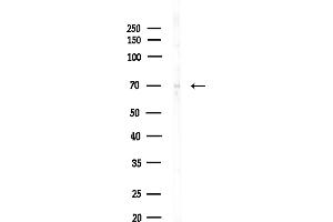 anti-Myotubularin 1 (MTM1) (C-Term) antibody