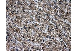 Immunohistochemical staining of paraffin-embedded Ovary tissue using anti-LOXmouse monoclonal antibody. (LOX Antikörper  (AA 22-168))