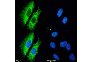 Immunofluorescence staining of fixed HeLa cells with anti-Cytokeratin 7 antibody OV-TL 12/30. (Rekombinanter Cytokeratin 7 Antikörper)