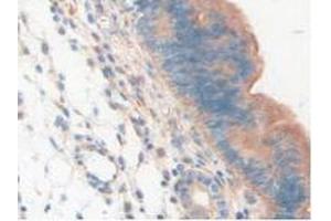 IHC-P analysis of Mouse Uterus Tissue, with DAB staining. (LAMP2 Antikörper  (AA 295-410))