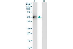 Western Blot analysis of TADA2L expression in transfected 293T cell line by TADA2L monoclonal antibody (M01), clone 4A8-1A7. (TADA2L Antikörper  (AA 1-305))