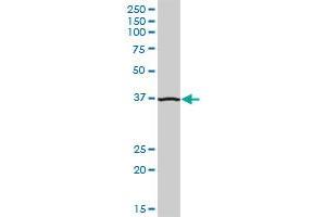 ADA MaxPab polyclonal antibody. (ADA Antikörper  (AA 1-363))