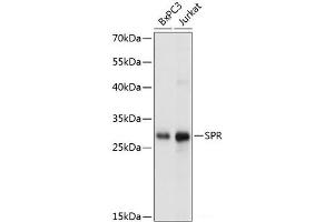 Western blot analysis of extracts of various cell lines using SPR Polyclonal Antibody at dilution of 1:1000. (SPR Antikörper)