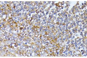 Immunohistochemistry (Paraffin-embedded Sections) (IHC (p)) image for anti-Eukaryotic Translation Initiation Factor 2B, Subunit 2 Beta, 39kDa (EIF2B2) antibody (ABIN7262969)