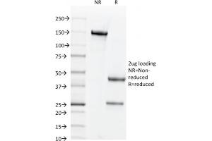 SDS-PAGE Analysis Purified CD44v6 Mouse Monoclonal Antibody (CD44V6/2496). (CD44 Antikörper)