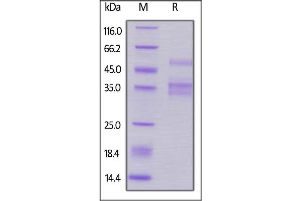 TACI Protein (AA 2-166) (Fc Tag,AVI tag,Biotin)
