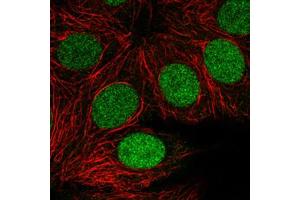 Immunofluorescent staining of MCF7 cells with PARP1 monoclonal antibody, clone CL2220  (Green) shows clear cycle dependent nuclear. (PARP1 Antikörper)
