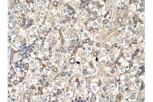 ST3GAL4 antibody was used for immunohistochemistry at a concentration of 4-8 ug/ml to stain Hepatocytes (arrows) in Human Liver. (ST3GAL4 Antikörper  (Middle Region))
