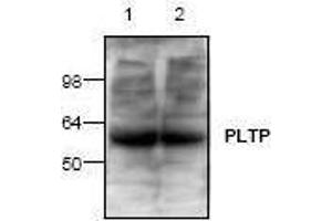 Image no. 1 for anti-Phospholipid Transfer Protein (PLTP) antibody (ABIN127227)