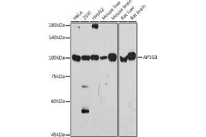 Western blot analysis of extracts of various cell lines, using G1 antibody (ABIN7265446) at 1:1000 dilution. (gamma 1 Adaptin Antikörper)