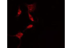 ABIN6275623 staining  HepG2 cells by IF/ICC. (CCT5 Antikörper  (Internal Region))
