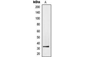 Western blot analysis of PMEPA1 expression in PC3 (A) whole cell lysates. (PMEPA1 Antikörper  (Center))