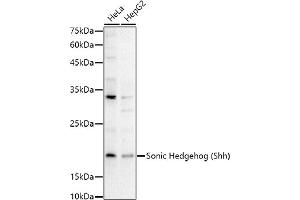 Western blot analysis of extracts of various cell lines, using Sonic Hedgehog (Shh) antibody (ABIN6134067, ABIN6147741, ABIN6147743 and ABIN6223662) at 1:1000 dilution. (Sonic Hedgehog Antikörper)
