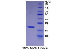 SDS-PAGE (SDS) image for Mannose-Binding Lectin (Protein C) 2, Soluble (MBL2) (AA 129-244) protein (His tag) (ABIN2125786)