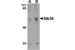 Western Blotting (WB) image for anti-serine threonine Kinase 39 (STK39) (C-Term) antibody (ABIN1030708) (STK39 Antikörper  (C-Term))