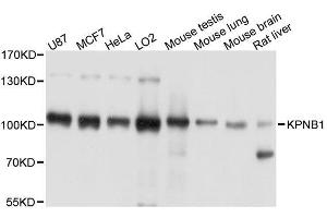 Western blot analysis of extracts of various cell lines, using KPNB1 antibody. (KPNB1 Antikörper  (AA 250-350))