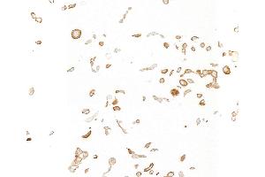 Immunocytochemistry (ICC) image for anti-Insulin-Like Growth Factor 1 Receptor (IGF1R) antibody (ABIN7795596)