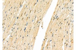 ABIN6261695 and ABIN6277334 at 1/100 staining Rat heart tissue by IHC-P. (FBXO32 Antikörper  (N-Term))