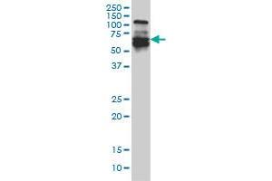IRF5 monoclonal antibody (M03), clone 1H6 Western Blot analysis of IRF5 expression in A-431 . (IRF5 Antikörper  (AA 395-504))
