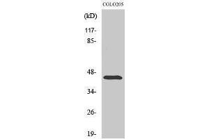 Western Blotting (WB) image for anti-Abhydrolase Domain Containing 12 (ABHD12) (Internal Region) antibody (ABIN3173622) (ABHD12 Antikörper  (Internal Region))