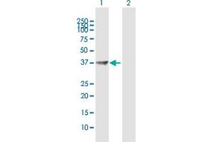 PPP1R3C antibody  (AA 1-317)