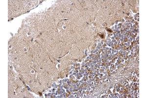 Immunohistochemistry (IHC) image for anti-Protein Phosphatase 1, Catalytic Subunit, beta Isoform (PPP1CB) (Center) antibody (ABIN2856078)