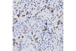 Immunohistochemistry (Paraffin-embedded Sections) (IHC (p)) image for anti-Hepatoma-Derived Growth Factor (HDGF) (AA 1-240) antibody (ABIN6141694)