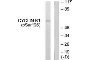 Western blot analysis of extracts from NIH-3T3 cells treated with EGF 200ng/ml 15', using Cyclin B1 (Phospho-Ser126) Antibody. (Cyclin B1 Antikörper  (pSer126))