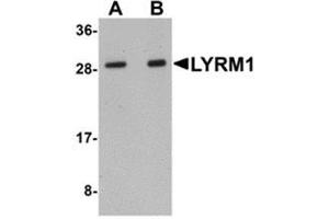 Western blot analysis of LYRM1 in human liver tissue lysate with LYRM1 antibody at (A) 1 and (B) 2 μg/ml. (LYRM1 Antikörper  (Center))
