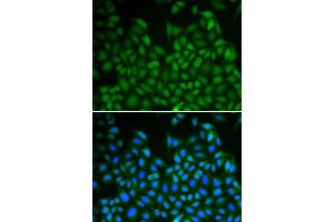 Immunofluorescence analysis of A549 cell using LHX8 antibody. (LHX8 Antikörper)