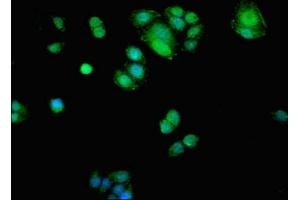 Immunofluorescence (IF) image for anti-Adenosine Kinase (ADK) (AA 18-256) antibody (ABIN7143291)