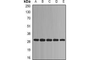 Western blot analysis of PSMA1 expression in Jurkat (A), Hela (B), HepG2 (C), mouse liver (D), mouse heart (E) whole cell lysates. (PSMA1 Antikörper)