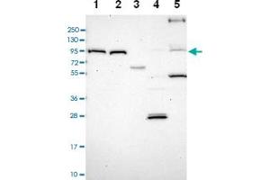 Western blot analysis of Lane 1: RT-4 Lane 2: U-251 MG Lane 3: Human Plasma Lane 4: Liver Lane 5: Tonsil with TRPV2 polyclonal antibody . (TRPV2 Antikörper)