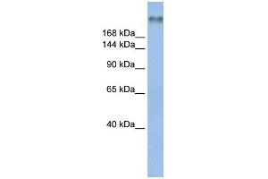WB Suggested Anti-SCN8A Antibody Titration:  0.