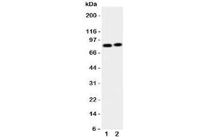 Western blot testing of Gelsolin antibody and Lane 1: HeLa;  2: A431 cell lysate. (Gelsolin Antikörper  (AA 763-775))