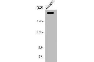 Western Blot analysis of COLO205 cells using APC Polyclonal Antibody (APC Antikörper  (C-Term))