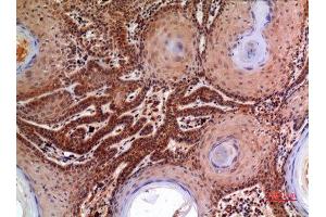 Immunohistochemistry (IHC) analysis of paraffin-embedded Human Skin, antibody was diluted at 1:100. (alpha 2 Macroglobulin Antikörper  (Internal Region))