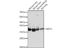 Western blot analysis of extracts of various cell lines, using B Rabbit mAb (ABIN1680181, ABIN7101458, ABIN7101459 and ABIN7101460) at 1:1000 dilution. (BCAP31 Antikörper)