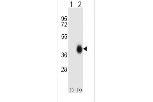 Western Blotting (WB) image for anti-Fc Fragment of IgA, Receptor For (FCAR) (AA 58-84) antibody (ABIN656839)
