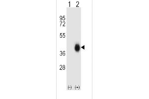 Western blot analysis of FCAR (arrow) using rabbit polyclonal FCAR Antibody (Center) (ABIN656839 and ABIN2846047). (FCAR Antikörper  (AA 58-84))