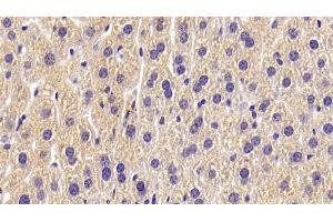 Detection of ALPL in Mouse Liver Tissue using Polyclonal Antibody to Alkaline Phosphatase, Tissue-nonspecific (ALPL) (ALPL Antikörper  (AA 18-335))