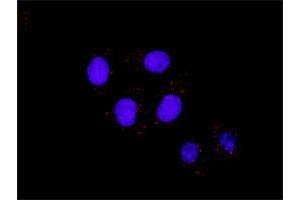 Representative image of Proximity Ligation Assay of protein-protein interactions between IKBKB and CTNNB1.