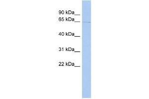 TIGD1 antibody used at 1 ug/ml to detect target protein. (IGD1 Antikörper  (Middle Region))