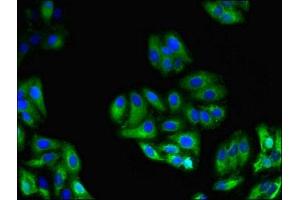 Immunofluorescent analysis of HepG2 cells using ABIN7154273 at dilution of 1:100 and Alexa Fluor 488-congugated AffiniPure Goat Anti-Rabbit IgG(H+L) (GPC4 Antikörper  (AA 19-210))
