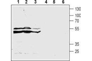 Western blot analysis of acute monocytic leukemia THP-1 (lanes 1 and 4), promyelocytic leukemia HL-60 (lanes 2 and 5) and chronic myelogenous leukemia K562 (lanes 3 and 6) human cell lysates: - 1-3. (CasLTR2 Antikörper  (3rd Extracellular Loop))